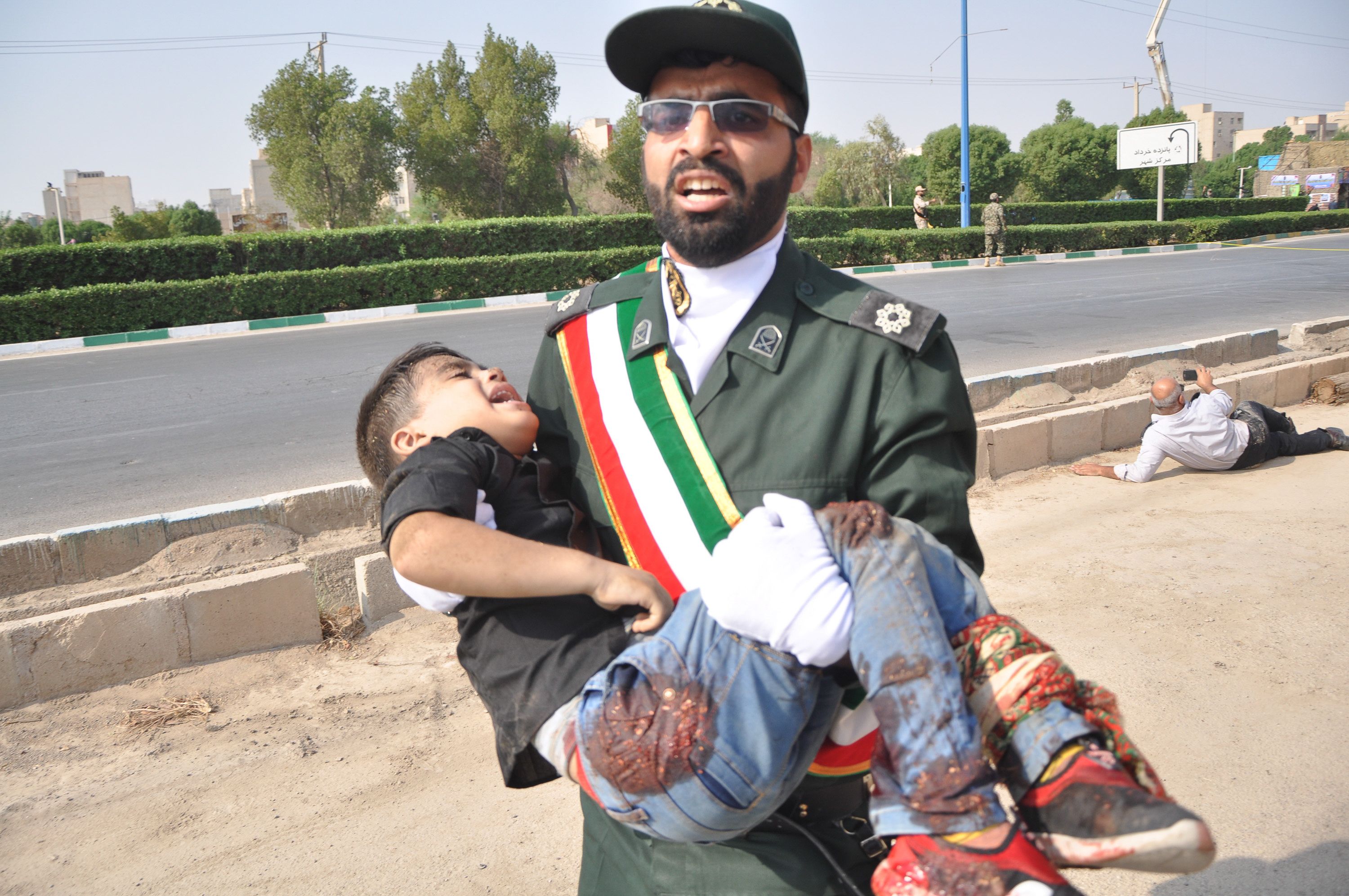 طفل مصاب فى هجوم الأهواز فى إيران