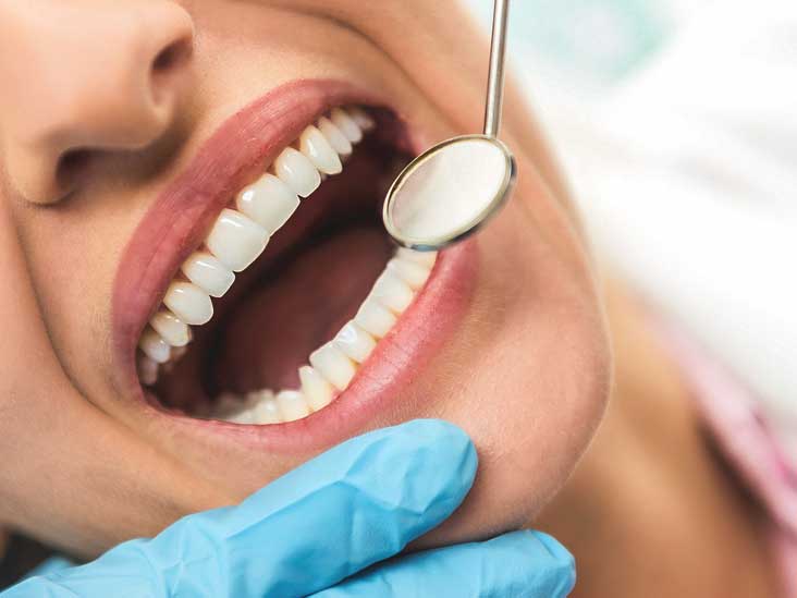 نصائح لعلاج تسوس الاسنان منها معجون الفلورايد