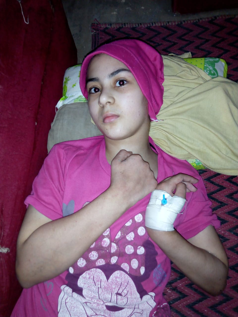 طفلة مصابة بورم بالمخ (2)