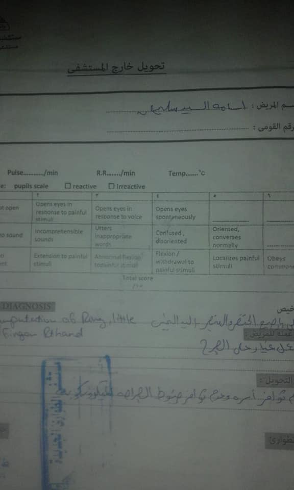 تحويل الحالة للعمليات تحويل الحالة للعمليات