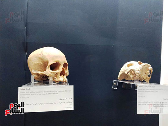 افتتاح معرض إعادة اكتشاف الموتى بالمتحف المصرى -  (1)