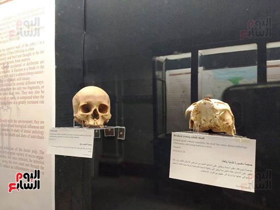 افتتاح معرض إعادة اكتشاف الموتى بالمتحف المصرى -  (9)