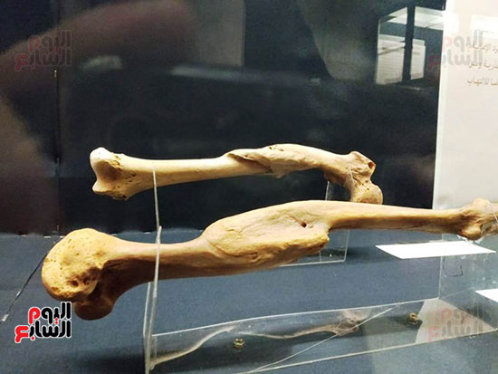 افتتاح معرض إعادة اكتشاف الموتى بالمتحف المصرى -  (5)