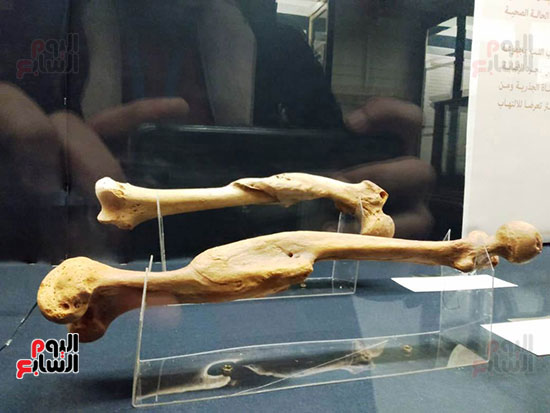 افتتاح معرض إعادة اكتشاف الموتى بالمتحف المصرى -  (24)
