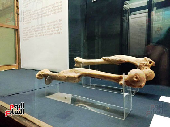 إعادة اكتشاف الموتى بالمتحف المصرى (6)