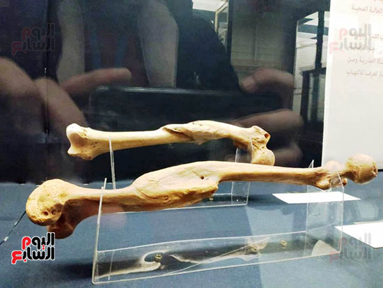إعادة اكتشاف الموتى بالمتحف المصرى (24)