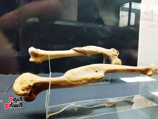 إعادة اكتشاف الموتى بالمتحف المصرى (5)