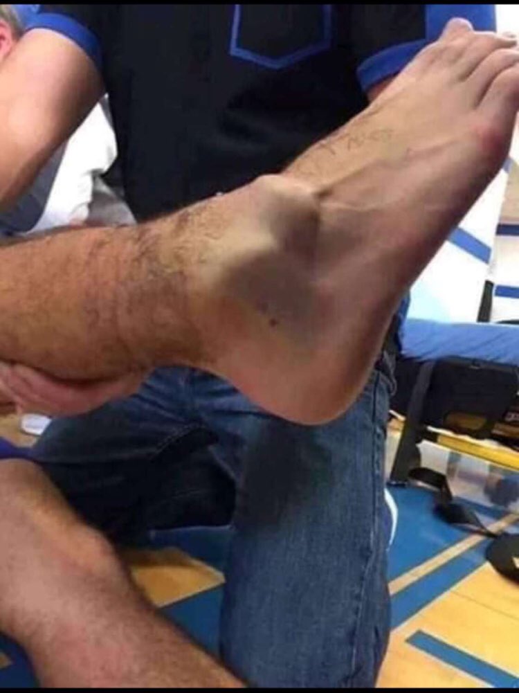 اصابة نيمار لاعب باريس سان جيرمان