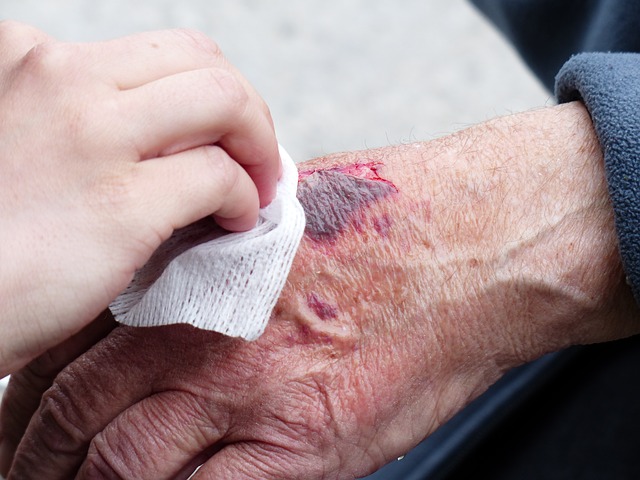 اصابات الجلد عند كبار السن