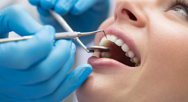 تنظيف الاسنان من البلاك لمنع التهاب اللثة