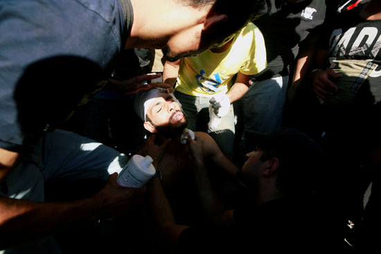 إصابة متظاهر بعد استنشاق الغاز