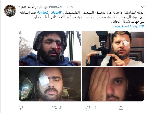 إعلاميون يتضامنون مع المصور معاذ عمارنة بعد فقد عينه برصاصة إسرائيلية. صور  (6)