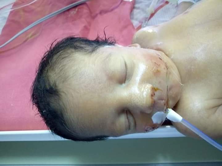 انقاذ طفلة من الموت بعد ولادتها بأنف مسدودة بالمحلة (1)