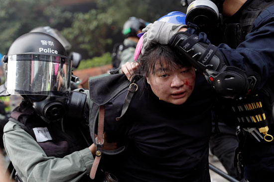 متظاهرة-مصابة-تعتقلها-قوات-الشرطة-فى-هونج-كونج