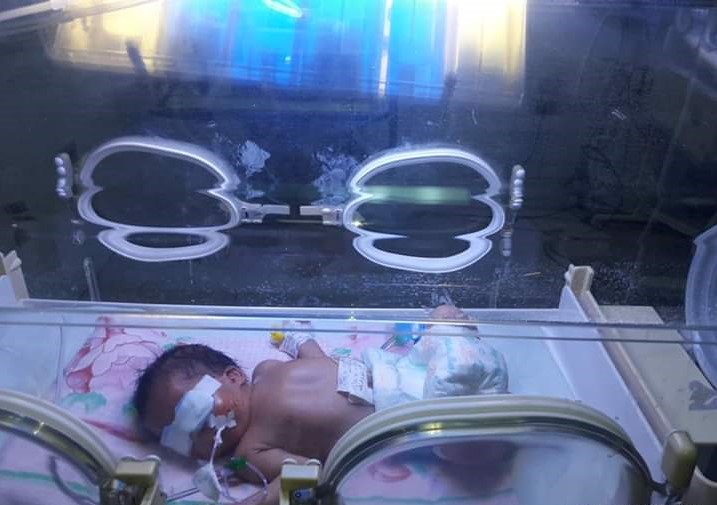 انقاذ طفلة من الموت بعد ولادتها بأنف مسدودة بالمحلة (2)