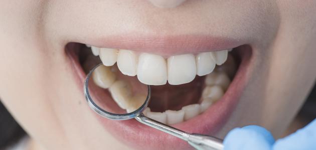 ما هي اسباب خراج الاسنان