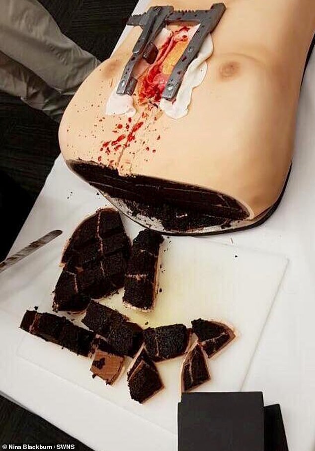كعكة تشبهه إنسان يجرى عملية قلب احتفالا بالذكرى المئوية لمستشفى بنيوزيلندا. (1)