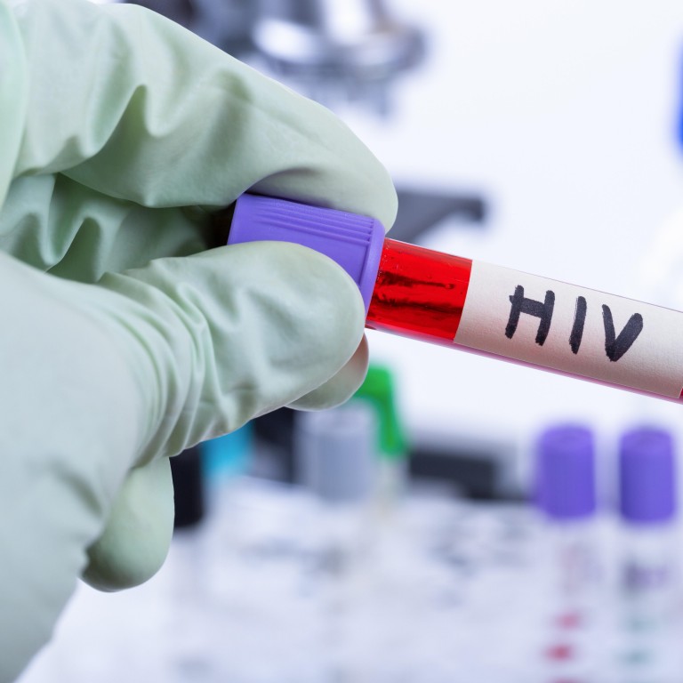 تحليل فيروس نقص المناعة البشرية