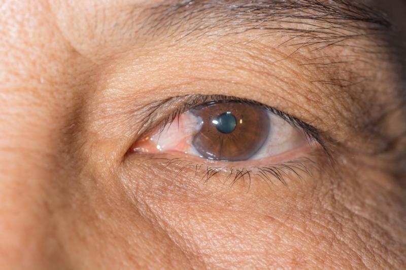 مرض بعيد المنال ينشأ عن زيادة ضغط العين Commertinsaat Com