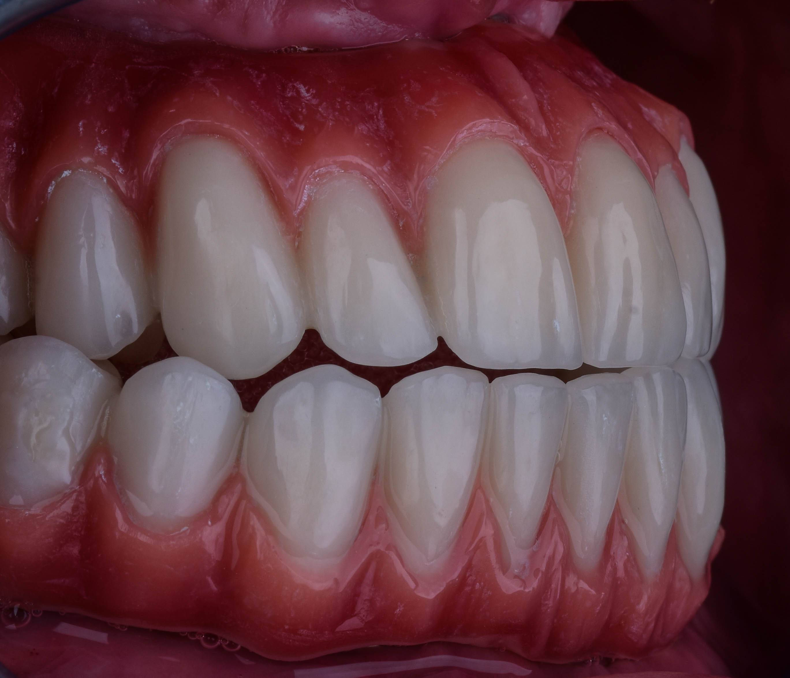 صورة للفك وكيفية ظهور شكل الأسنان فى مركز شاينى وايت