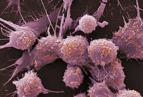 نمو الخلايا السرطانية