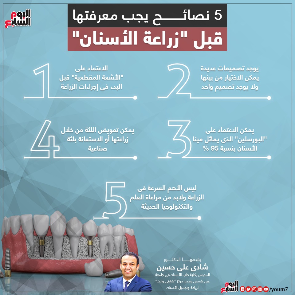إنفوجراف الدكتور شادى على حسين يقدم نصائح قبل زراعة الأسنان