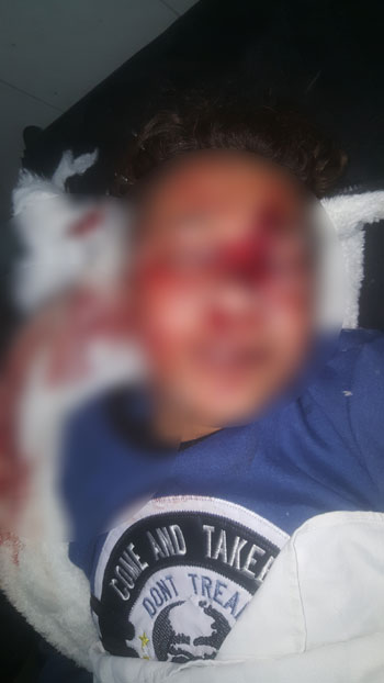 معاذ بعد الحادثة معاذ بعد الحادثة