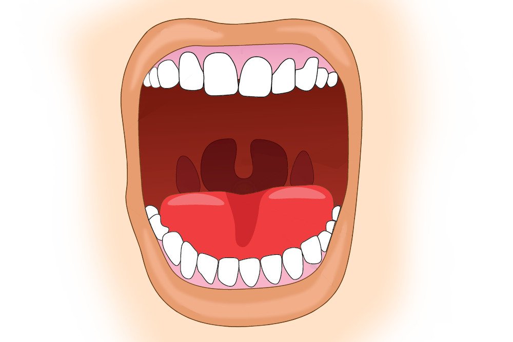 اعراض سرطان الفم