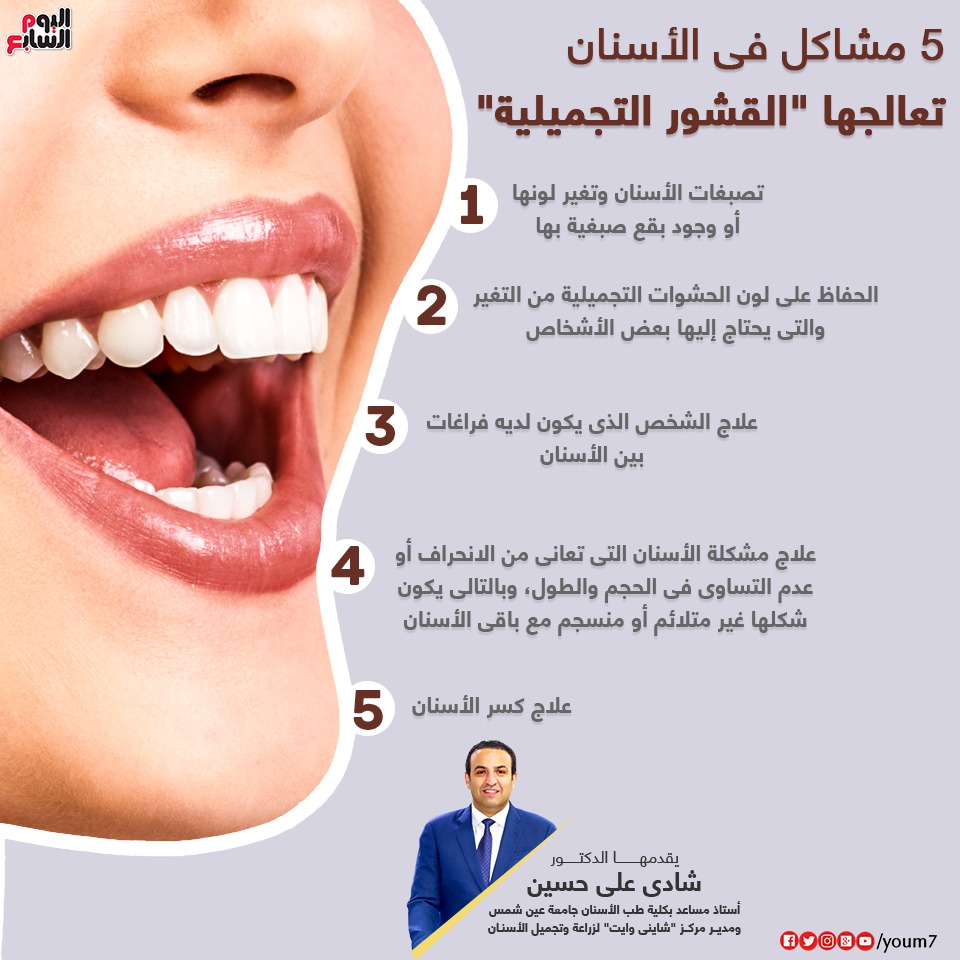 انفوجراف يوضح 5 مشاكل للأسنان تعالجها القشور التجميلية