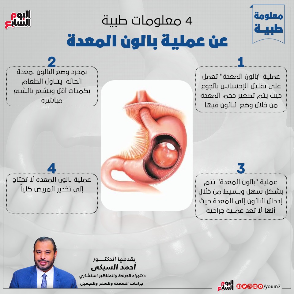إنفوجراف الدكتور أحمد السبكى يقدم معلومات طبية عن بالون المعدة