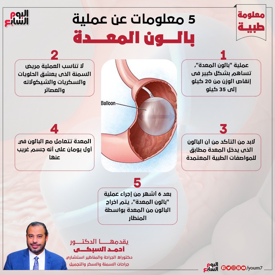 إنفوجراف دكتور أحمد السبكى يقدم معلومات حول عملية بالون المعدة