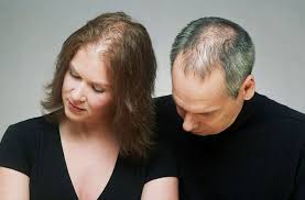 Hair loss treatment 4