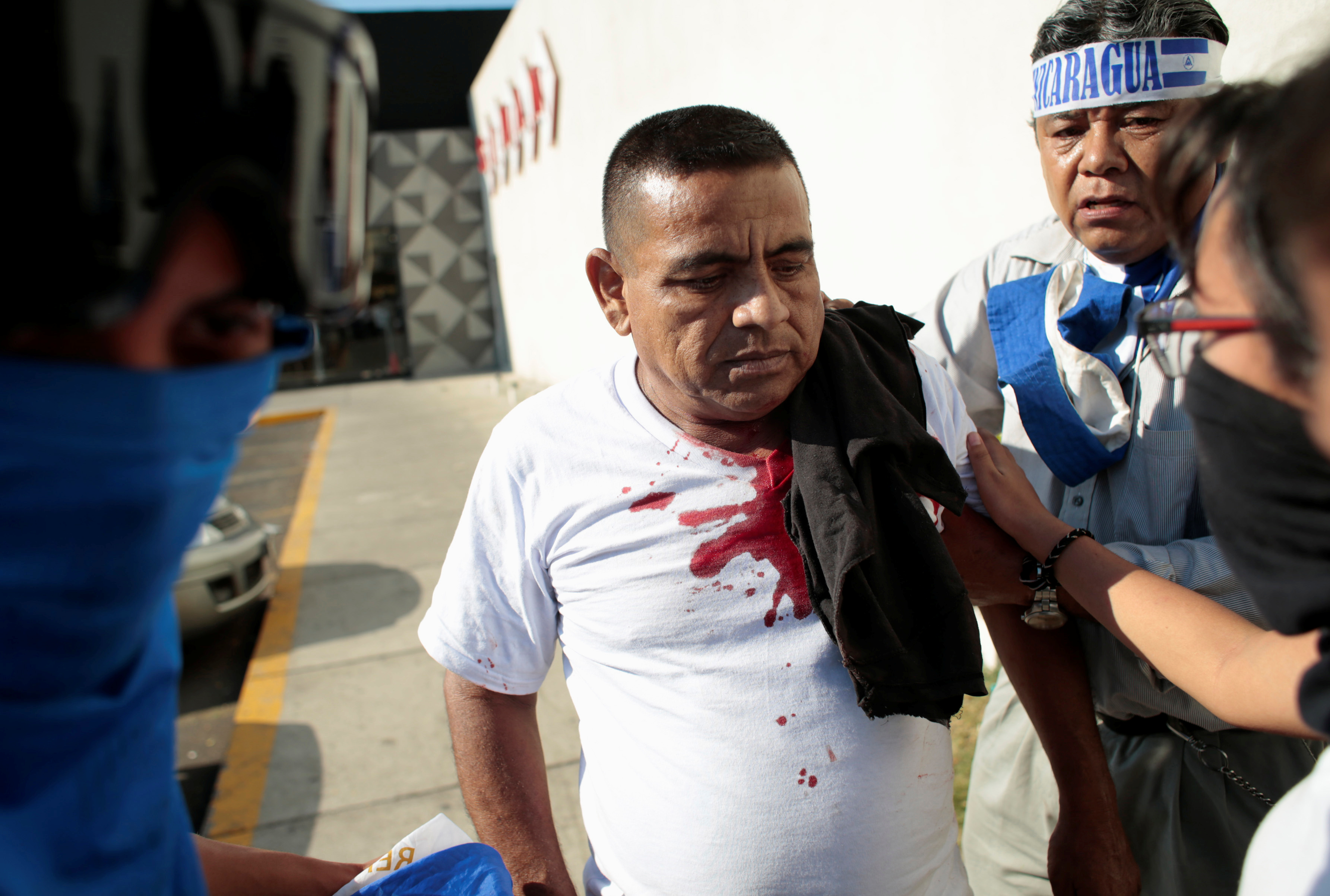 أثار الدماء على قميص أحد المتظاهرين جراء العنف
