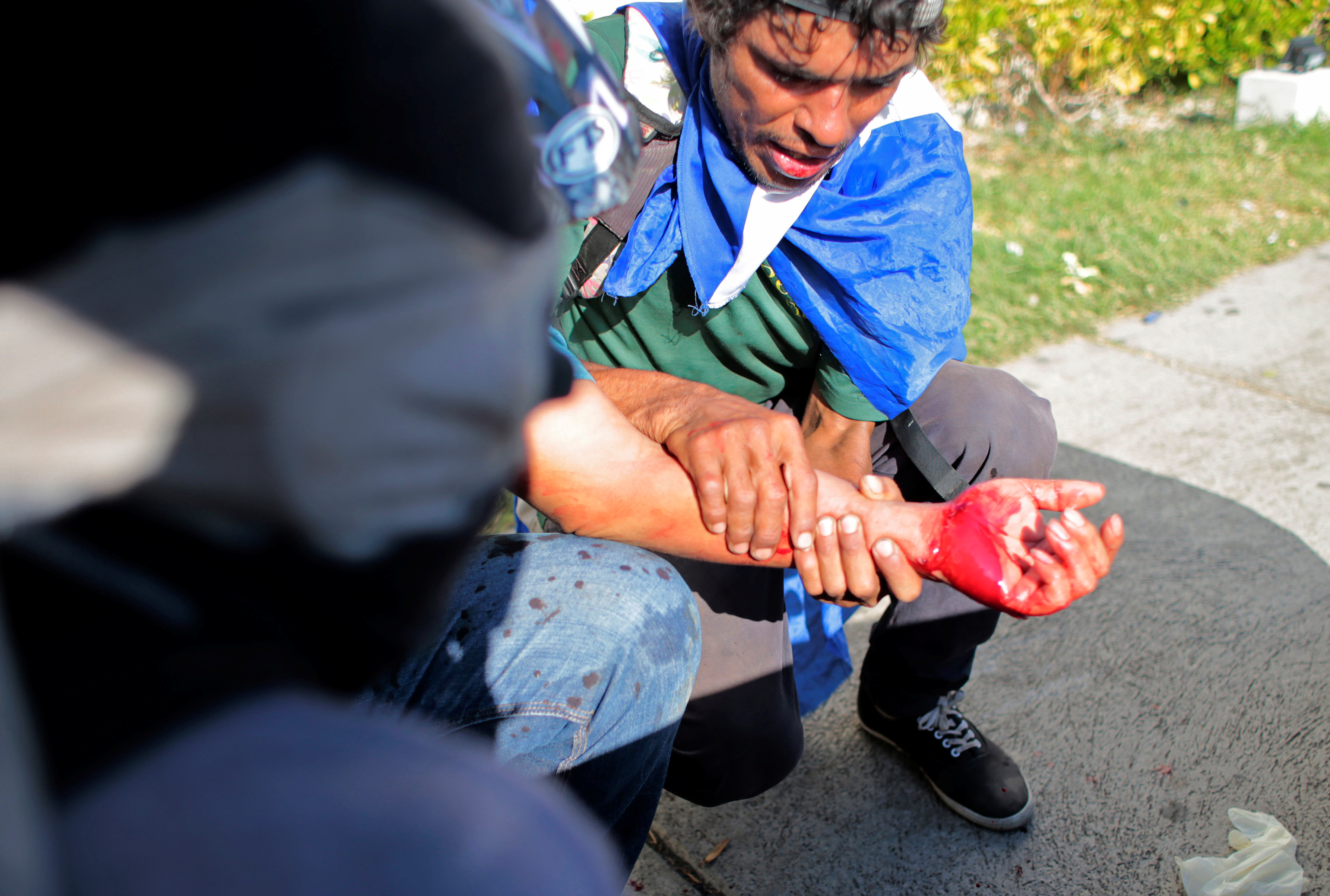 متظاهر أصيب خلال الاحتجاج