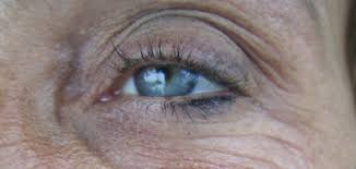 العيون وعلامات تقدم العمر