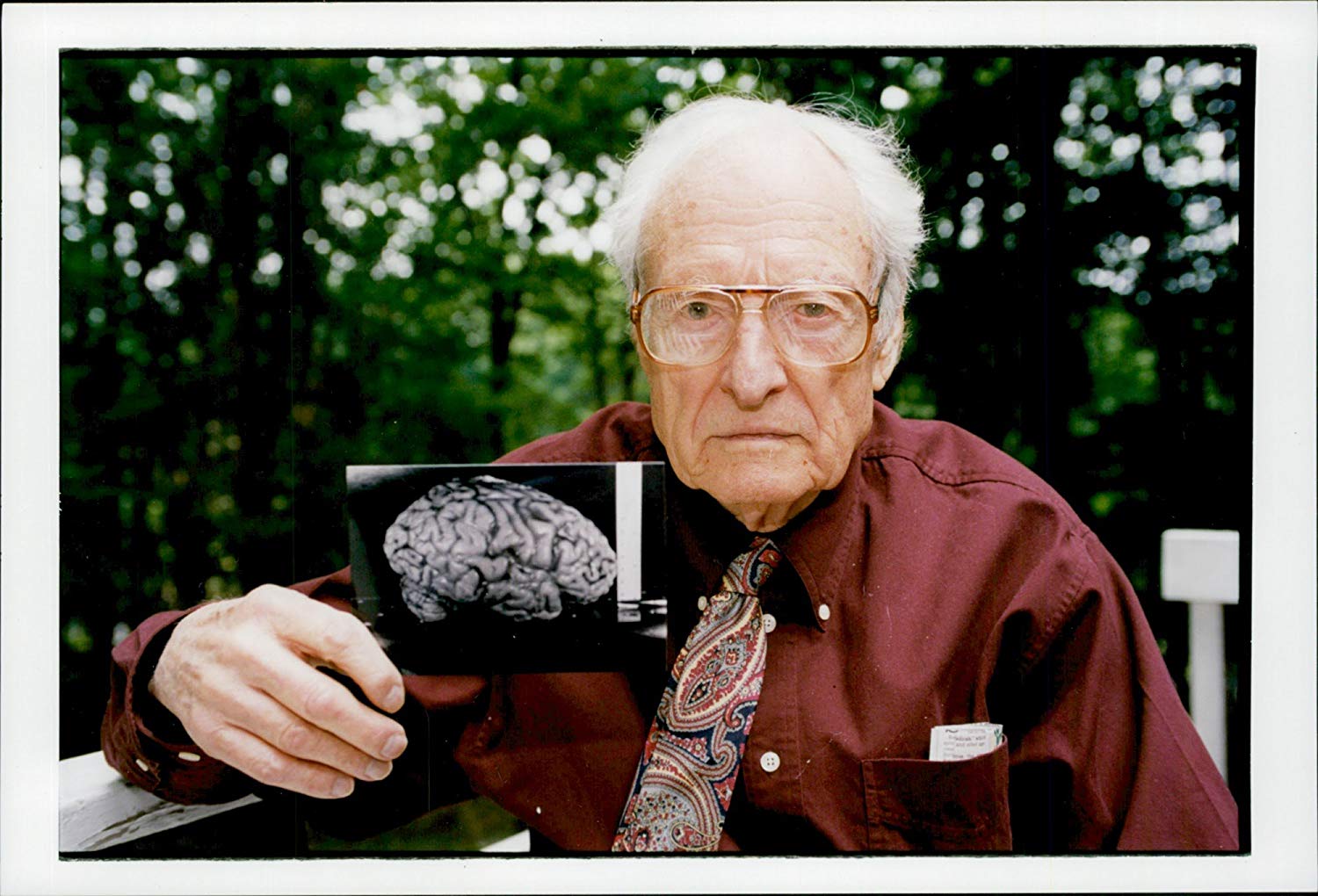 توماس هارفى يحمل صورة لمخ آينشتاين