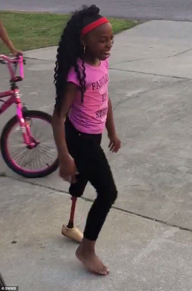 طفلة ترقص بساق صناعية بعد بتر قدمها بسبب مرض  (1)