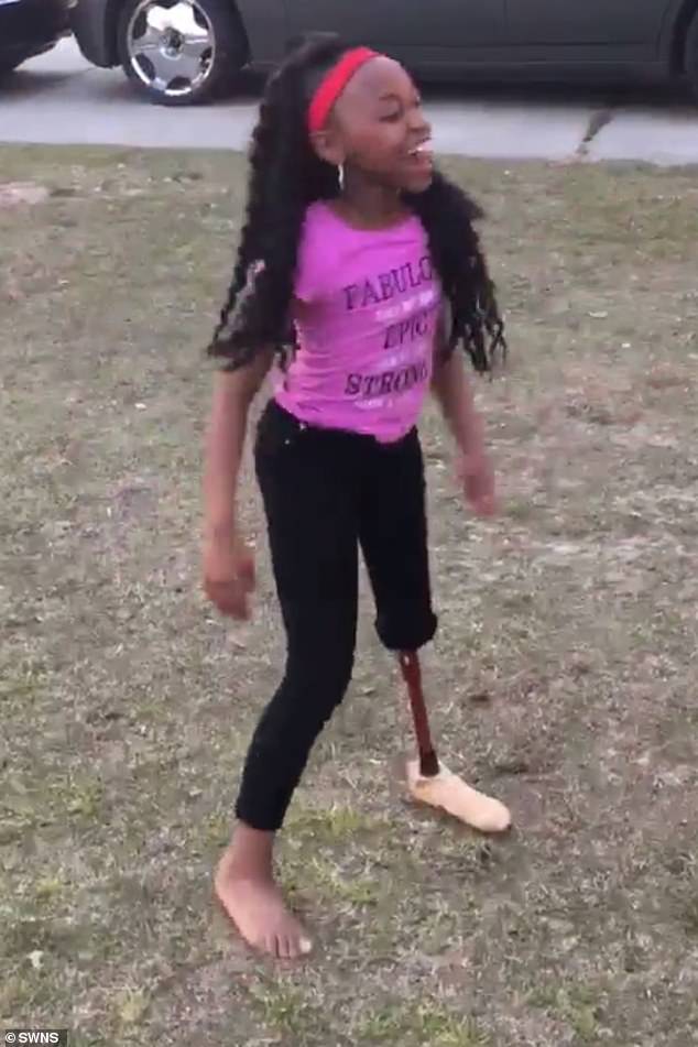 طفلة ترقص بساق صناعية بعد بتر قدمها بسبب مرض  (2)