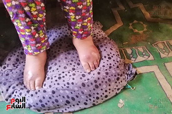 مأساة شقيقتين من سوهاج مصابتين بالشلل (4)