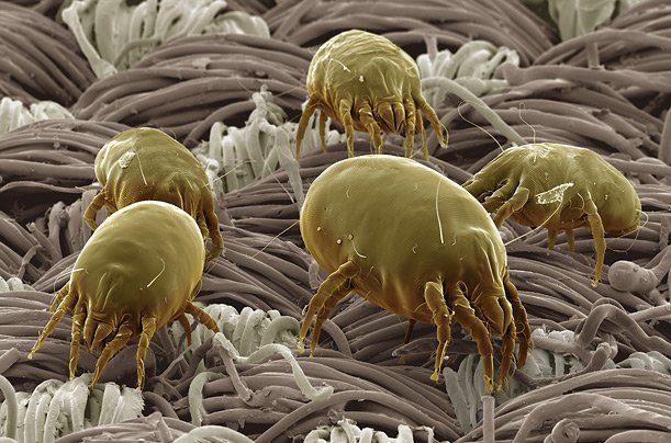 حشرة عث الغبار تتغذى على خلايا الجلد الميت