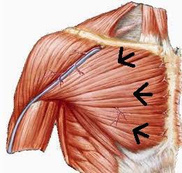 أنواع العضلات الصدرية
