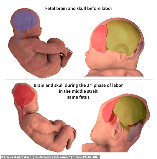 مراحل تغير جمجمة الطفل عند الولادة