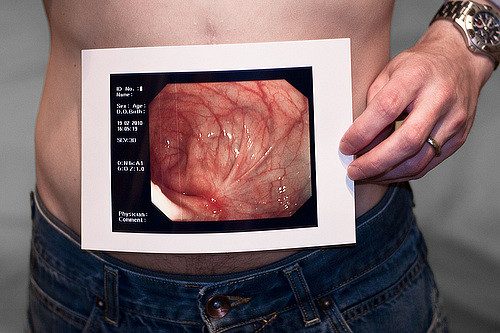 crohns-disease-1132x670