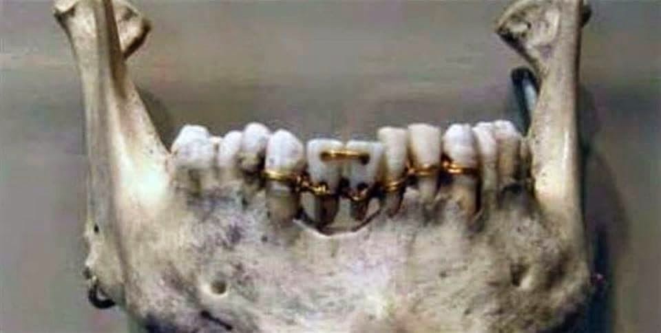 الاسنان عند قدماء المصريين