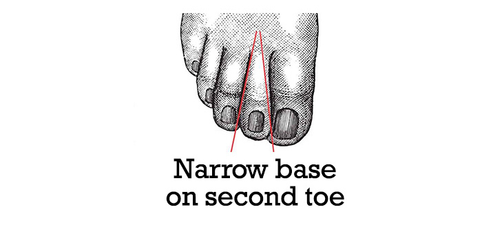Narrow-base-on-second-toe-10
