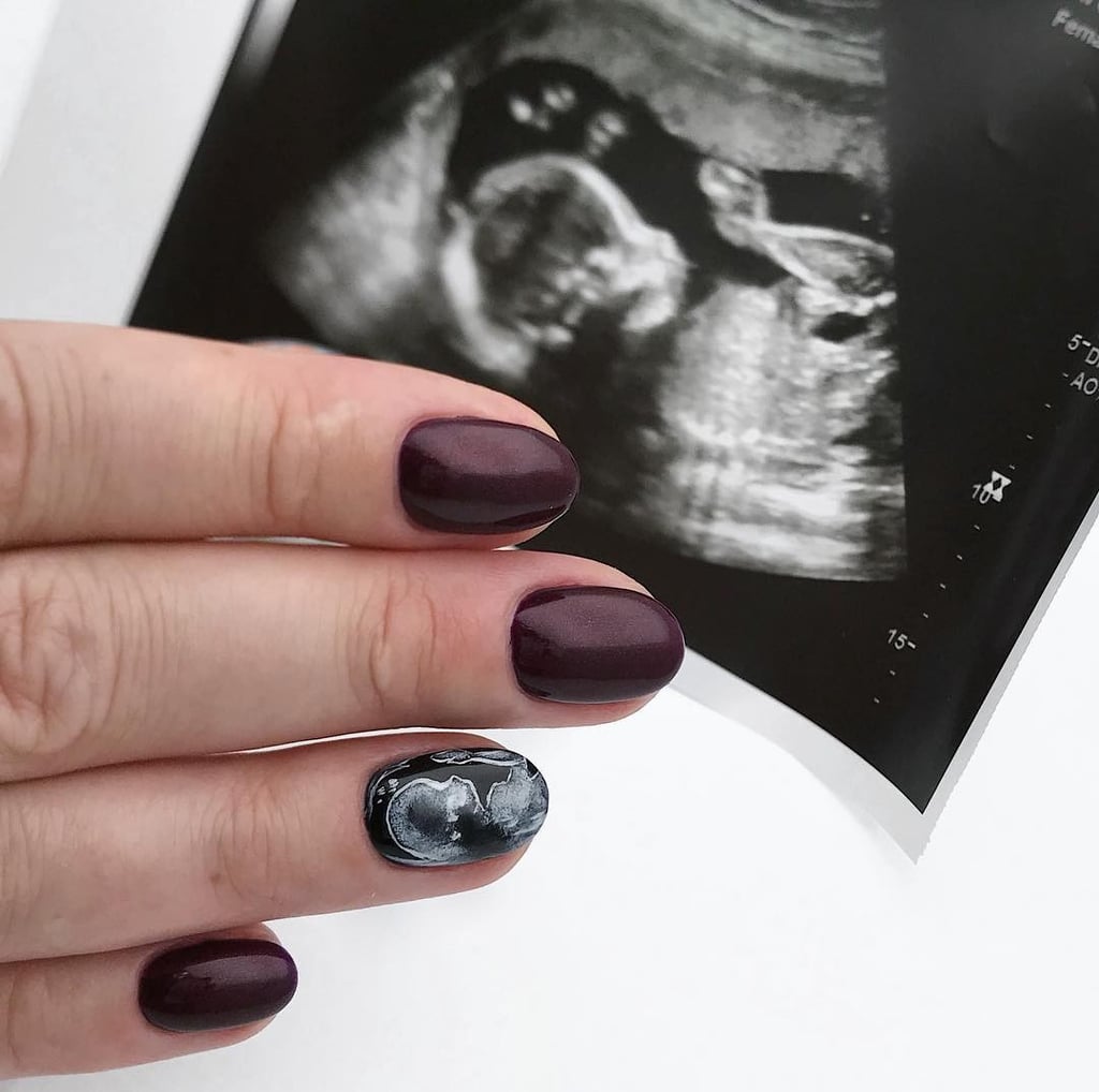 ultrasound-nails-01