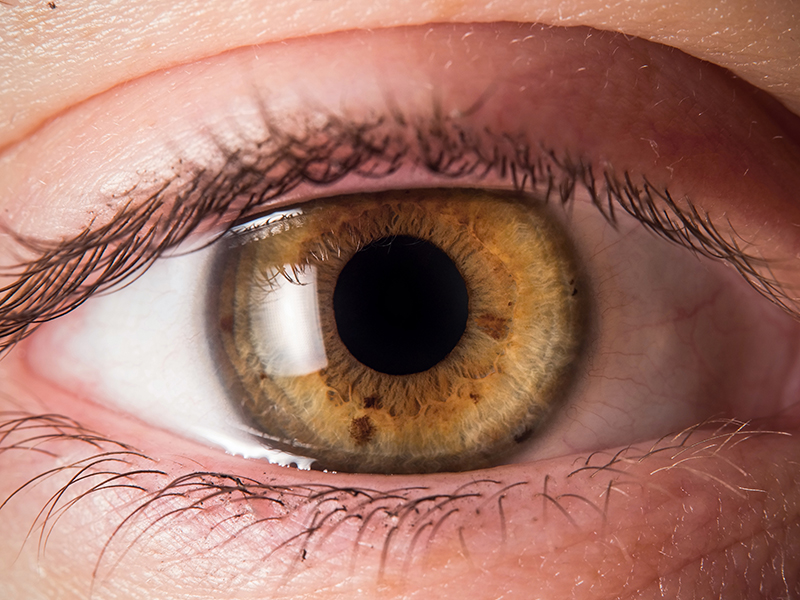 ما هو سرطان العين