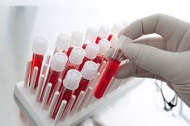 انواع اختبارات الدم