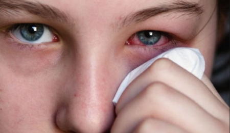 التهاب العين من اعراض مرض بهجت