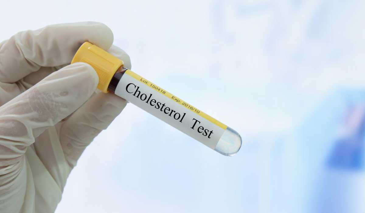 اختبار الكولسترول في الدم